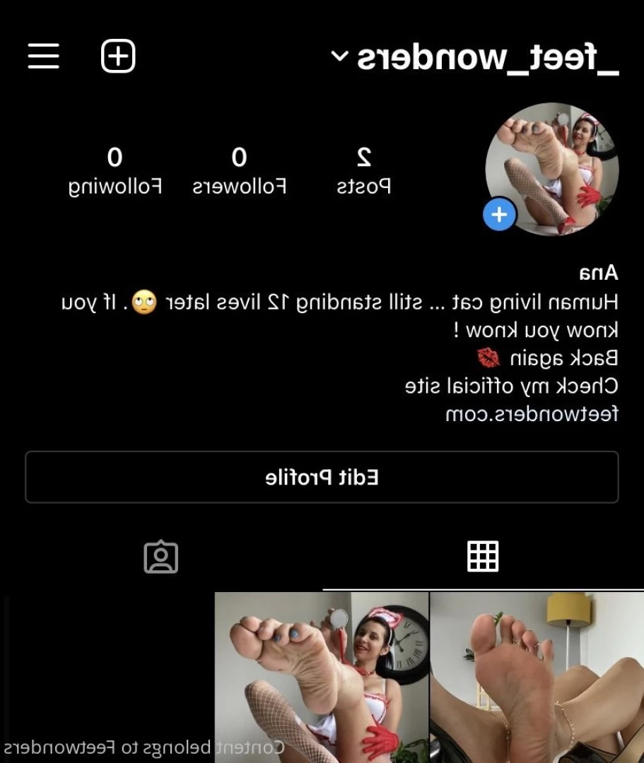 feetwonders Onlyfans leaked photo 10497726 on Hotleaks.tv