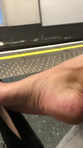 feetwonders Onlyfans leaked video 12107251 on Hotleaks.tv