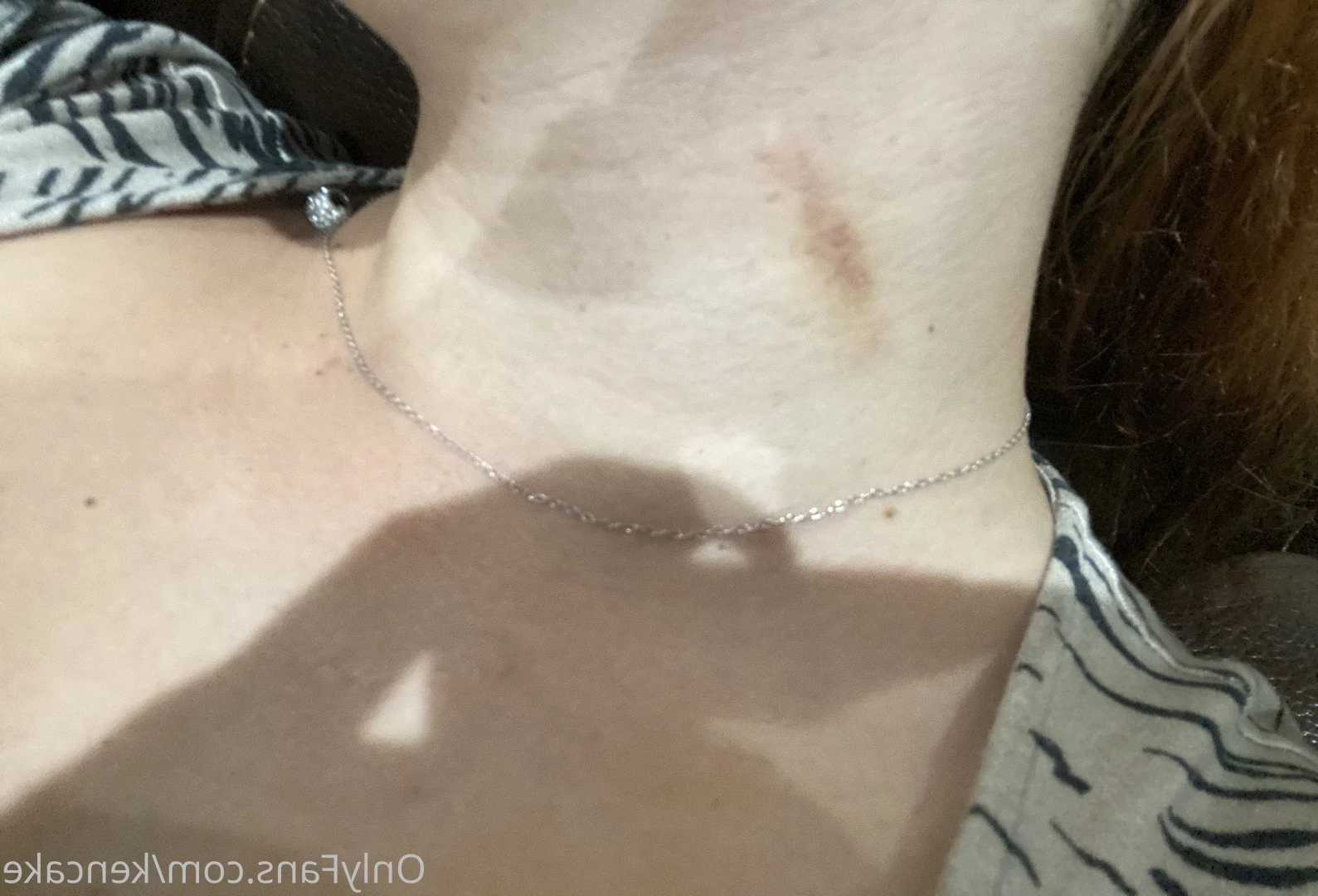 GiNGER FACIALS 👩🏻‍🦰🤤 [ kencake ] Onlyfans leaked photo 608975 on Hotleaks.tv