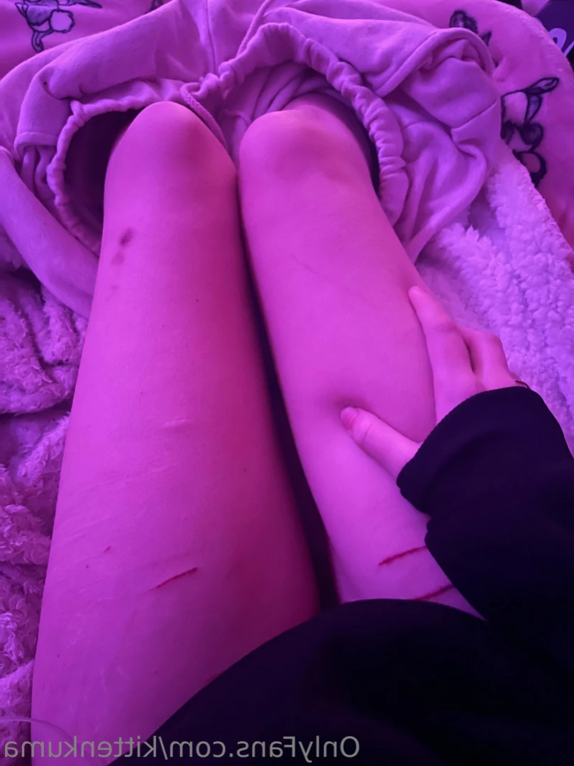 kat ♡ [ kittenkuma ] Onlyfans leaked photo 15003050 on Hotleaks.tv