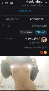 7379972