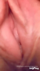 15963157