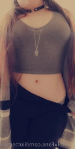 7331081