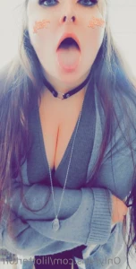 7331120