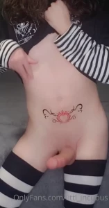 7285249