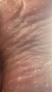 7230179