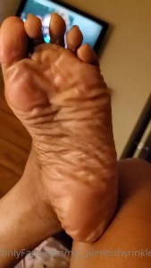 7119433