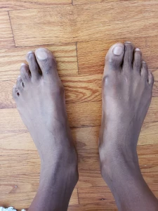 7036962