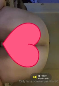 15144562