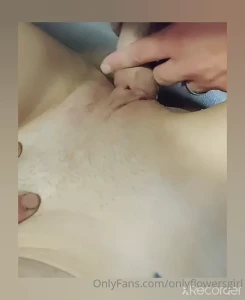 7079372