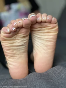 7195177