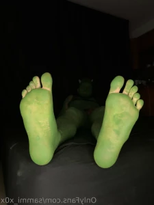 7146418