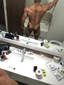 7081452