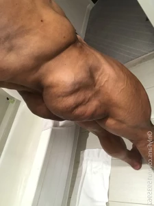 7081560