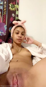 7104551