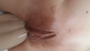 6876237