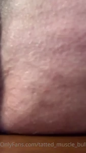 6776387