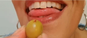 10431756