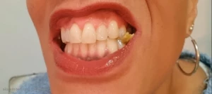 10431764