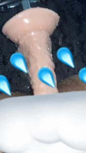 6631657