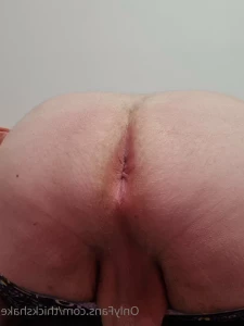 6991560