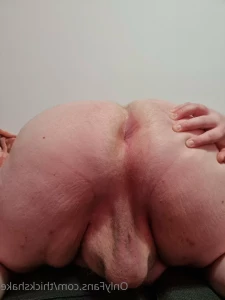 6991631