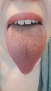 6635290
