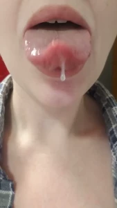 6635314
