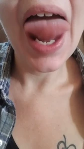 6635328