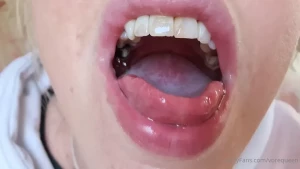 6513779