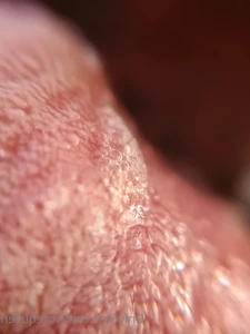 6887646