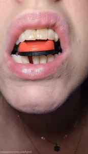 6887725