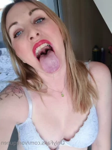 6887741