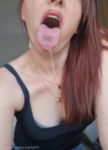 6887996