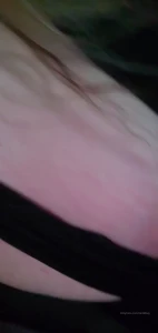 7796619