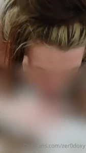 7796625