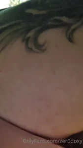 7796641