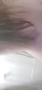 7796643