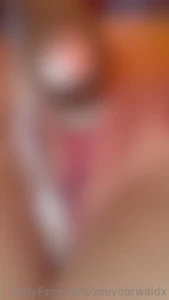 7796430