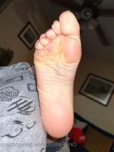 9416665