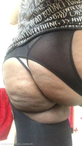 16247735