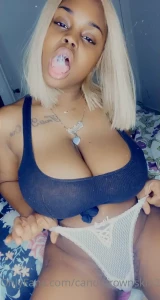 8382720