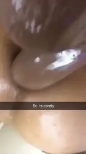 8380528