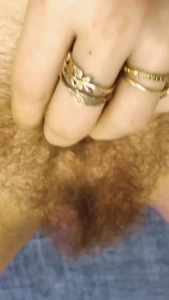 8377642