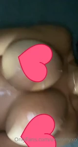 16176951