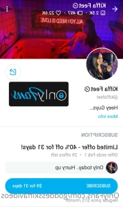 9398381