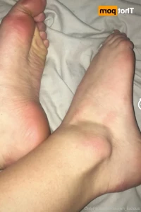 16217164