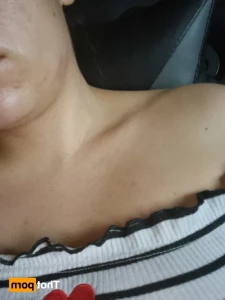 14572743