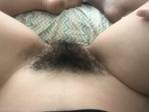 15559231