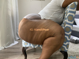 17242674